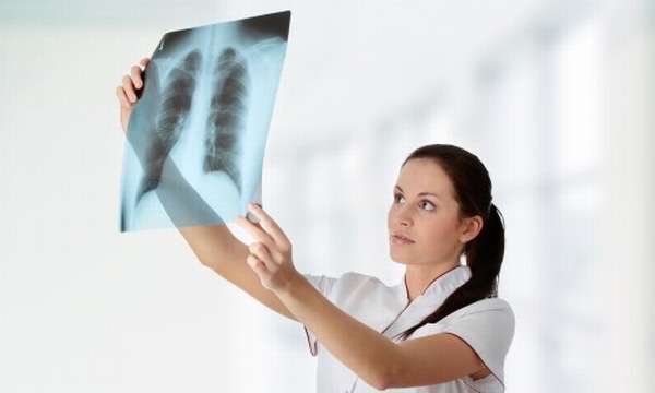 врач смотрит рентген легких 